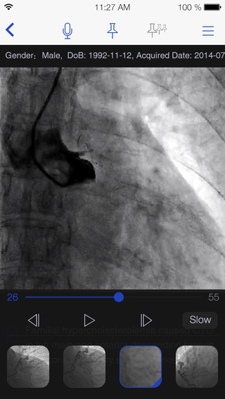 DrSoon(醫(yī)學(xué)影像傳輸工具) v1.6.0 安卓版 1