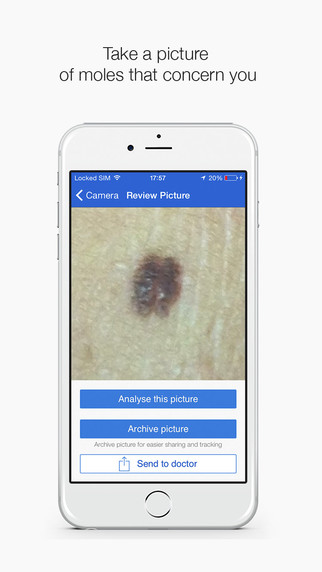 SkinVision apk v1.4.3 安卓版 1