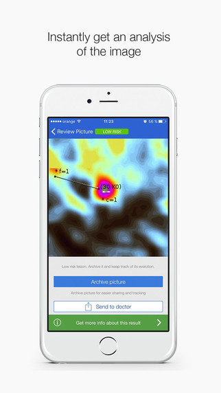 SkinVision apk v1.4.3 安卓版 2