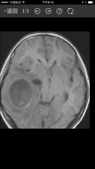 病例分享 v0.0.1 安卓版 0