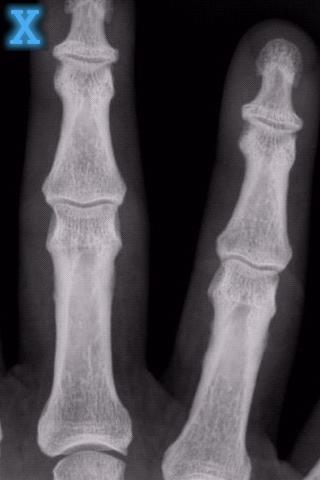 550.jpg X射線掃描app