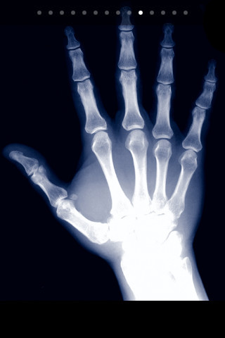 x射線掃描儀手機(jī)版 v1.7.6 安卓版 1