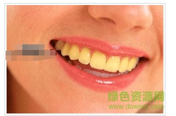 PS牙齒美白濾鏡