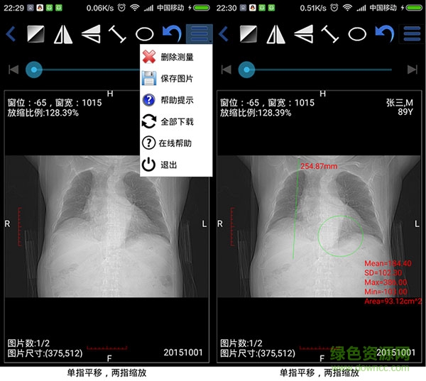 医影在线 医影在线