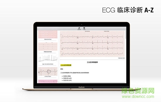 ECG臨床診斷mac版 v1.0 蘋果電腦版 0
