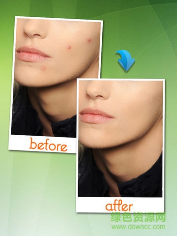 photo eraser手機(jī)版