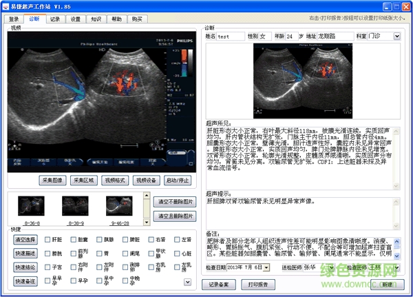 超聲工作站正式版下載