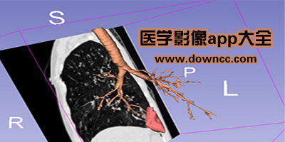 醫(yī)學影像app