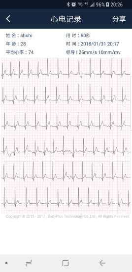 body plus智心愛(ài)護(hù)監(jiān)測(cè) v1.1.7 安卓版 3