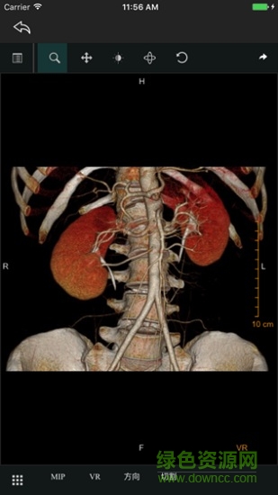 linkeye(醫(yī)學(xué)影像) v1.6 安卓版 0