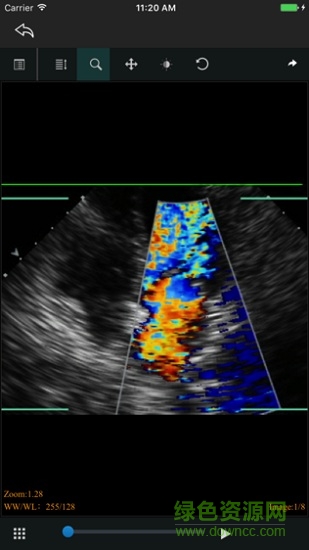 linkeye(醫(yī)學(xué)影像) v1.6 安卓版 2