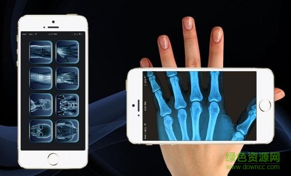 X光掃描儀神奇之作中文版 v1.0.0 安卓版 1