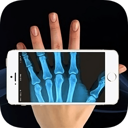 X光掃描儀神奇之作中文版