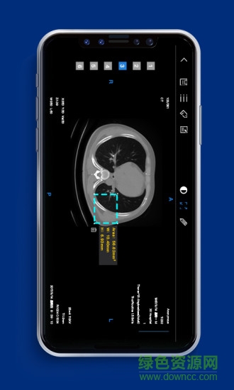 dicomlabel手機(jī)版