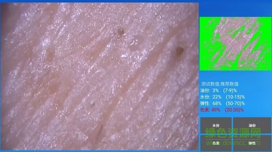 mrkv智能頭皮皮膚檢測(cè) v20241206V37.0 安卓最新版 0