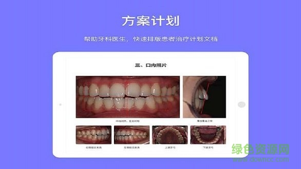 牙e寶 牙e寶安卓版