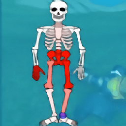 骨折模擬器手機版