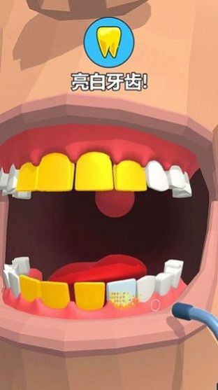 拔牙大師dentist bing v0.1.2 安卓版 0