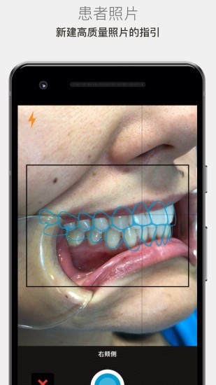 Invisalign Photo Uploader軟件(照片上傳應用) v5.4.0 安卓版 1