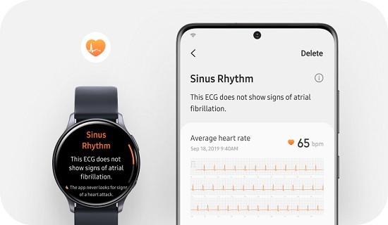samsung health monitor apk漢化版 v1.1.0.183 安卓版 1