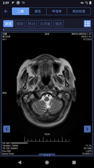 東軟睿影官方版 v1.0.0025.000000.00 安卓版 1