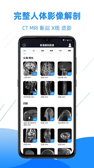 醫(yī)學影像解剖圖譜 v4.2.0 安卓版 2
