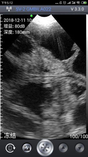 智能b超軟件(smartvus) v3.8.3 安卓版 0