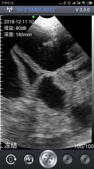 智能b超 智能b超安卓版