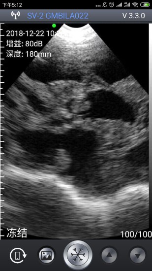 智能b超軟件(smartvus) v3.8.3 安卓版 2