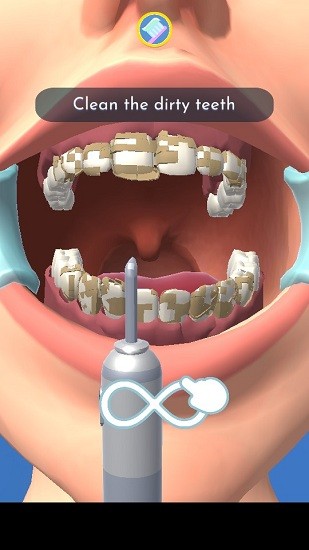 完美牙醫(yī)3d手游 v1.0.3 安卓版 0