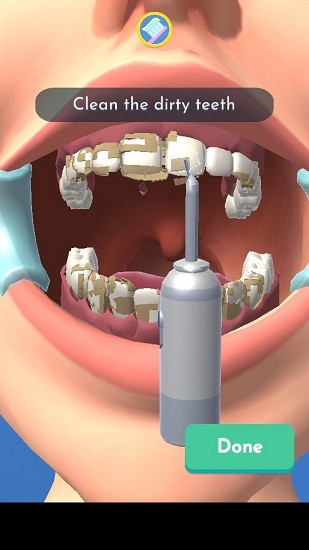 完美牙醫(yī)3d手游 完美牙醫(yī)3d最新版