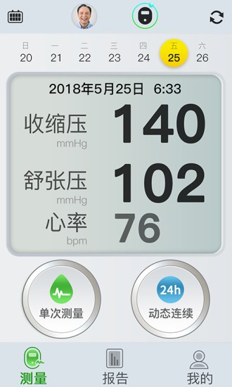無袖帶血壓計(jì) 無袖帶血壓計(jì)app