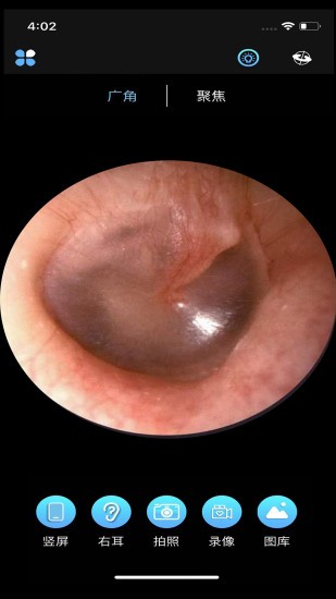 alk可視采耳 v1.3.4 安卓版 0