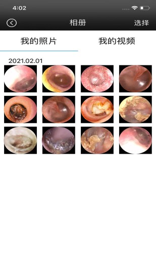 alk可視采耳 v1.3.4 安卓版 3