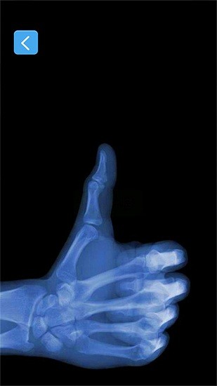 真实x射线模拟器 x射线模拟器