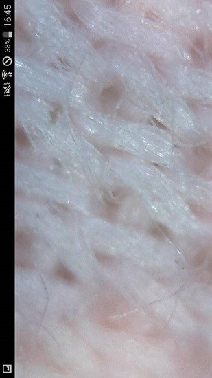 endoscope endoscope安卓版