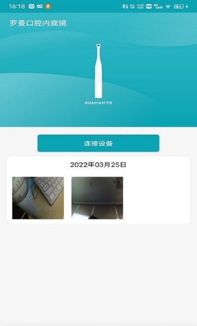 羅曼口腔內(nèi)窺鏡 v1.0.0 安卓版 3