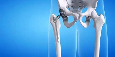 骨科app推薦-骨科醫(yī)院掛號(hào)預(yù)約平臺(tái)-骨科在線app