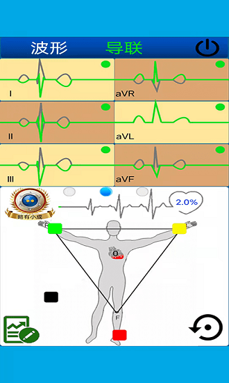 心電圖計(jì)算器最新版 v1.2.1 安卓版 1