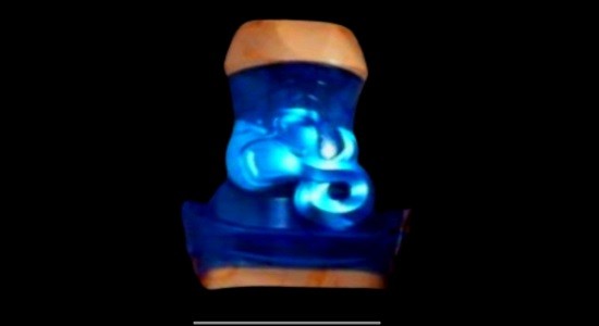 阿基蕾娜驅(qū)動器游戲 v1.2 安卓版 2