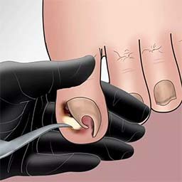 沉浸式減壓高手