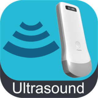 无线超声探头app