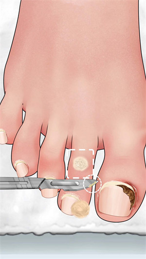 沉浸式修腳大師 v1.0 安卓版 1