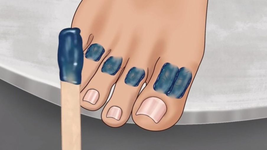 修腳足疔模擬器 v1.0 安卓版 0