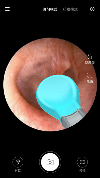 xlife智能可視采耳棒 v1.0.45 安卓版 3