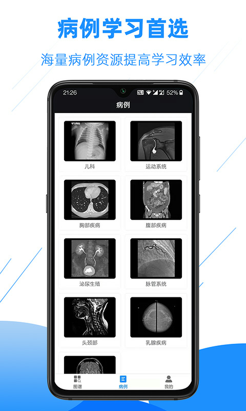 醫(yī)學影像解剖圖譜 v4.2.0 安卓版 4