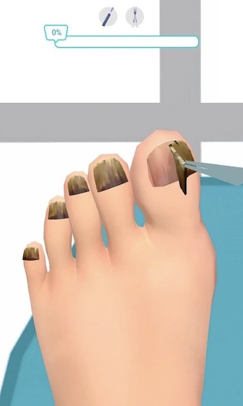 足部诊所模拟 v1.1.1 安卓版1