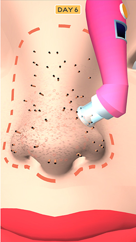 鼻子美容師 v1.0.2 安卓版 0