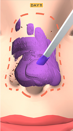 鼻子美容師 v1.0.2 安卓版 1