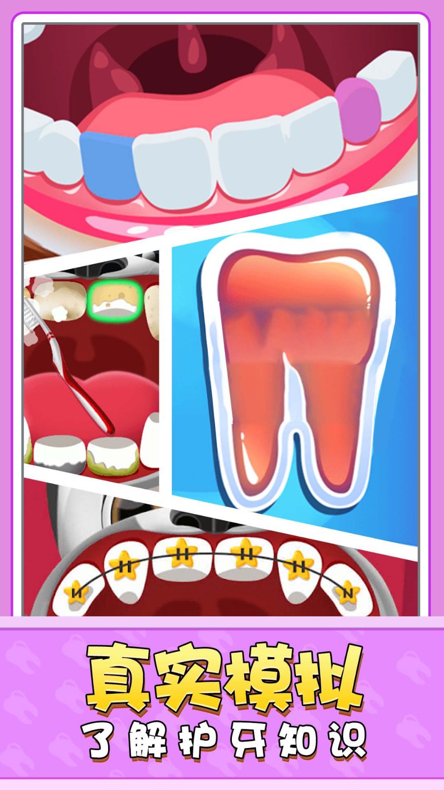 寶寶牙醫(yī)模擬器 v1.0.0 安卓版 0